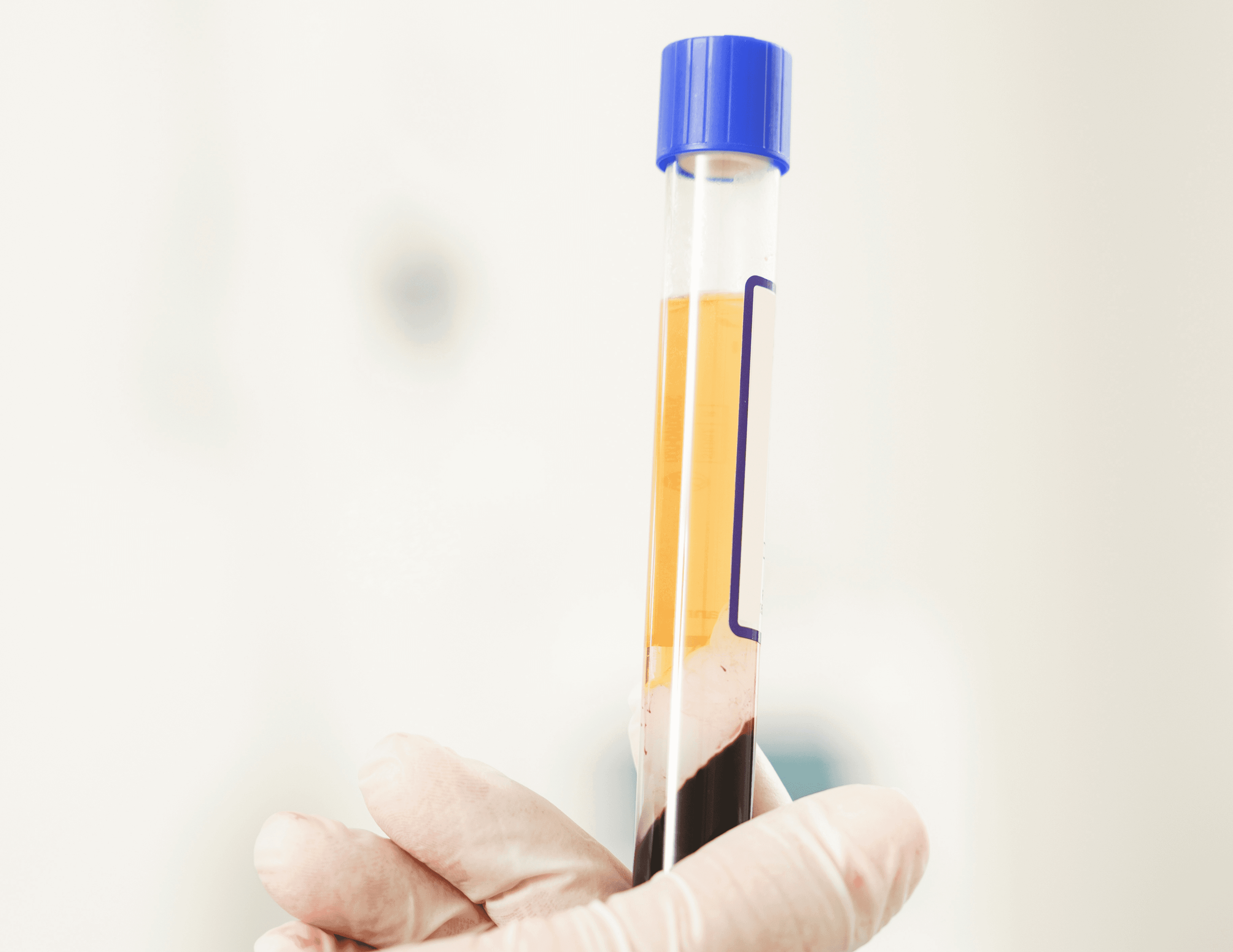 PRP Injection Per Area Only
