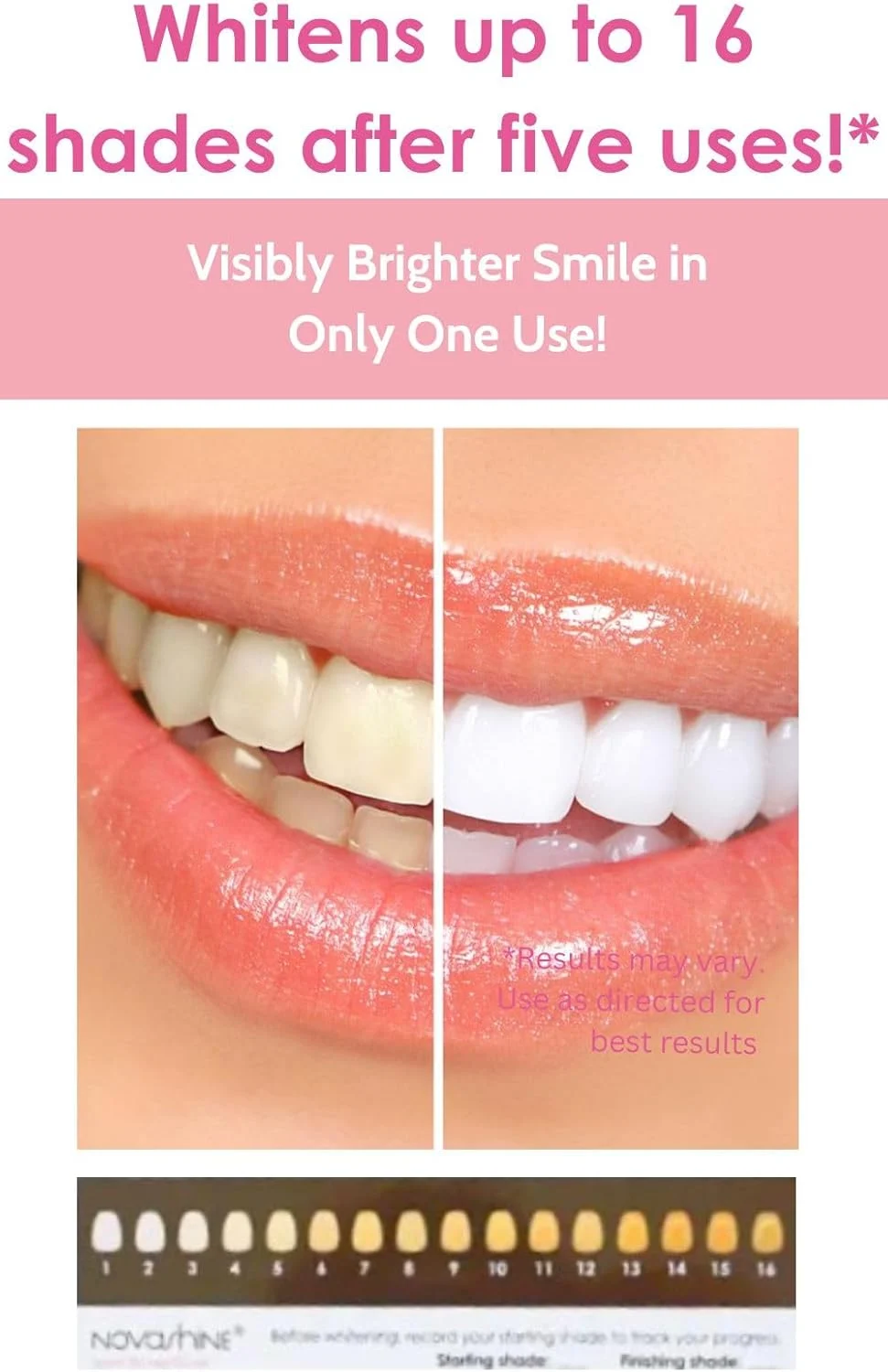 Novashine Professional Teeth Whitening Kit – Advanced LED & Peroxide Gel - thumbnail 7