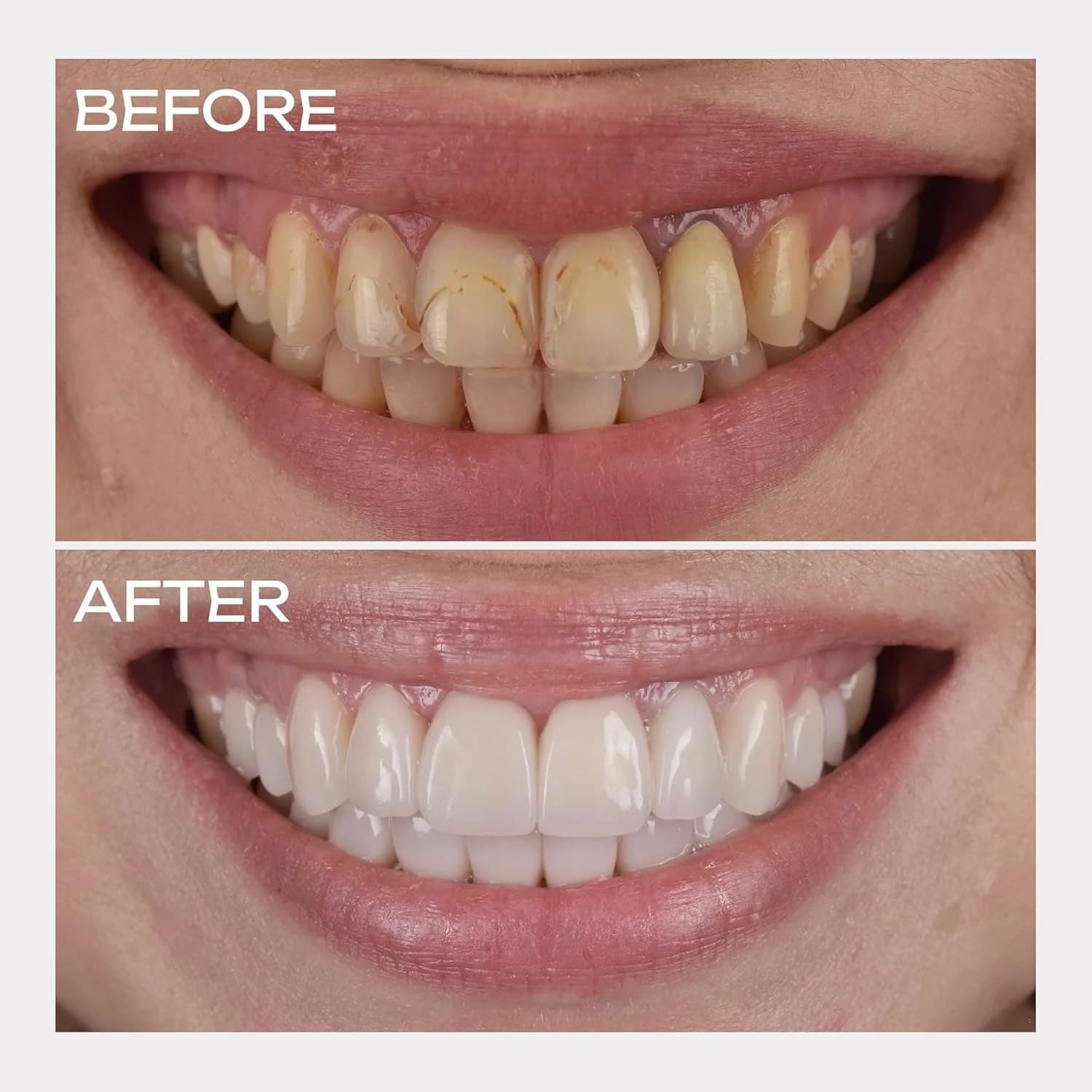 Purple Color-Correcting Teeth Whitening Foam – Gentle Daily Brightening - thumbnail 4