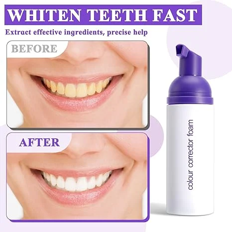 Purple Toothpaste for Teeth Whitening – Complete Kit - thumbnail 5