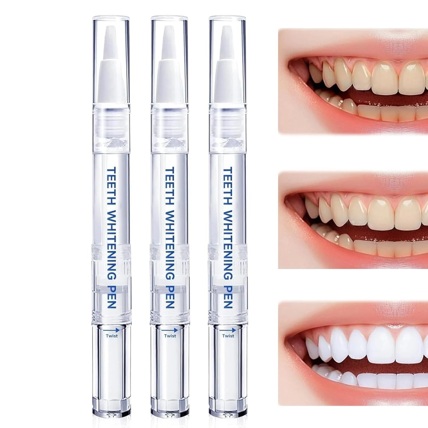 Teeth Whitening Pen – Professional, Enamel Safe & Travel-Friendly