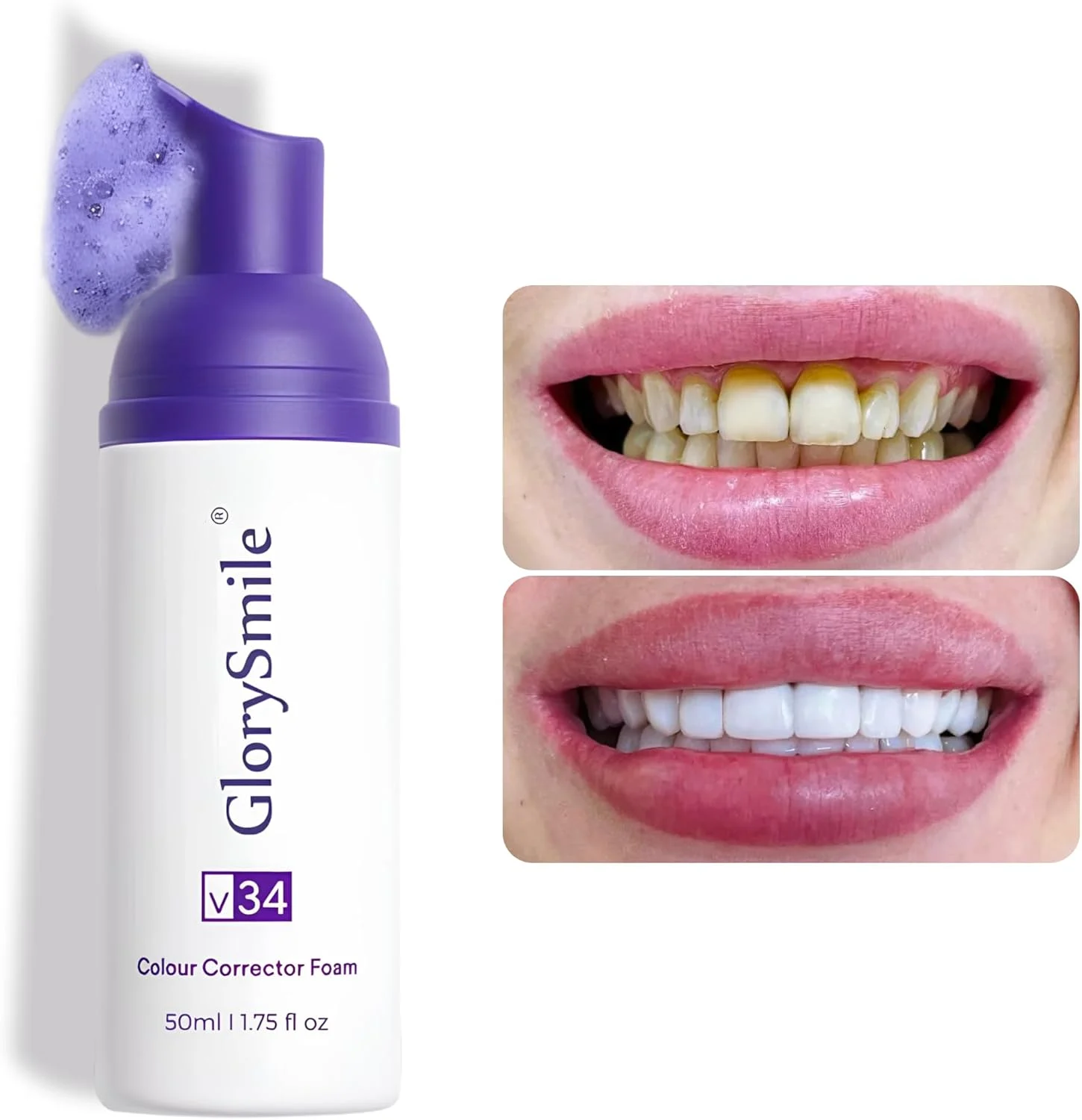Purple Color-Correcting Teeth Whitening Foam – Gentle Daily Brightening