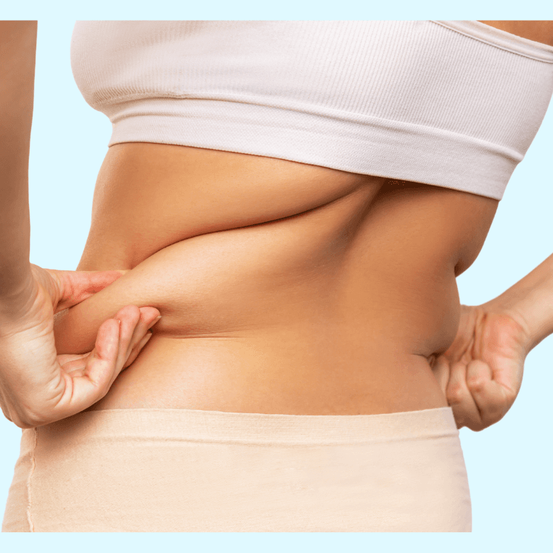 CoolSculpting Elite (Back or Bra Fat Package)