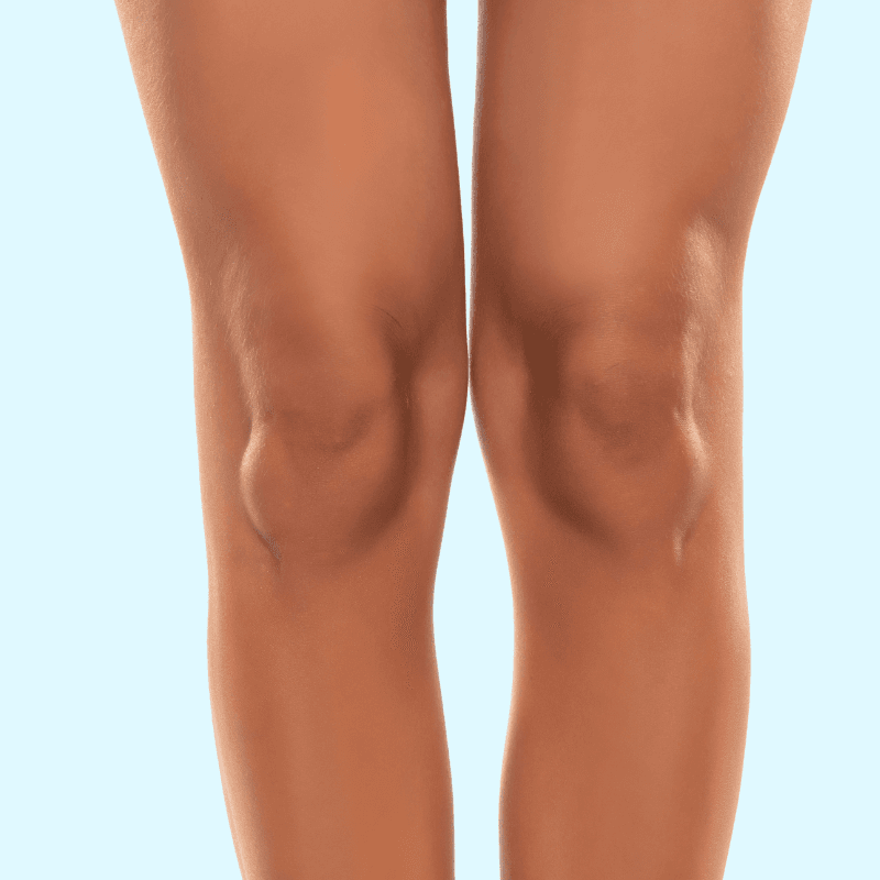 CoolSculpting Elite (Above the Knee Package)
