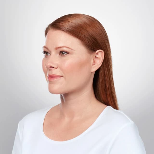 Chin Contouring