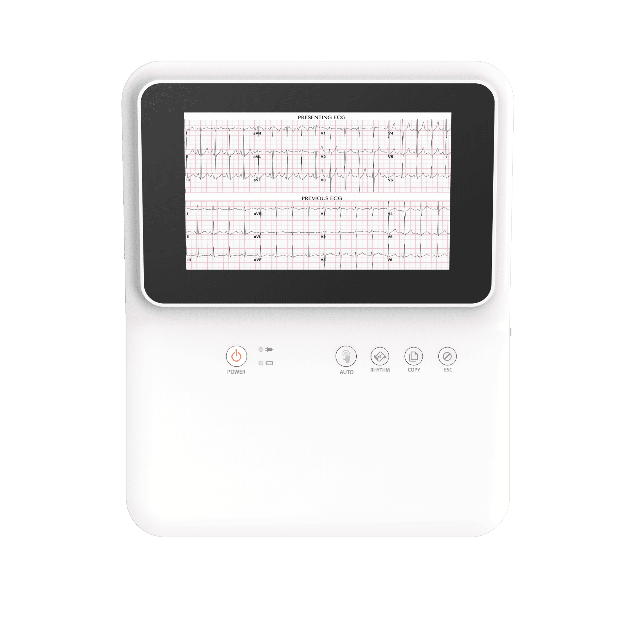 CardioTech GT-50 12-Channel Resting ECG Machine