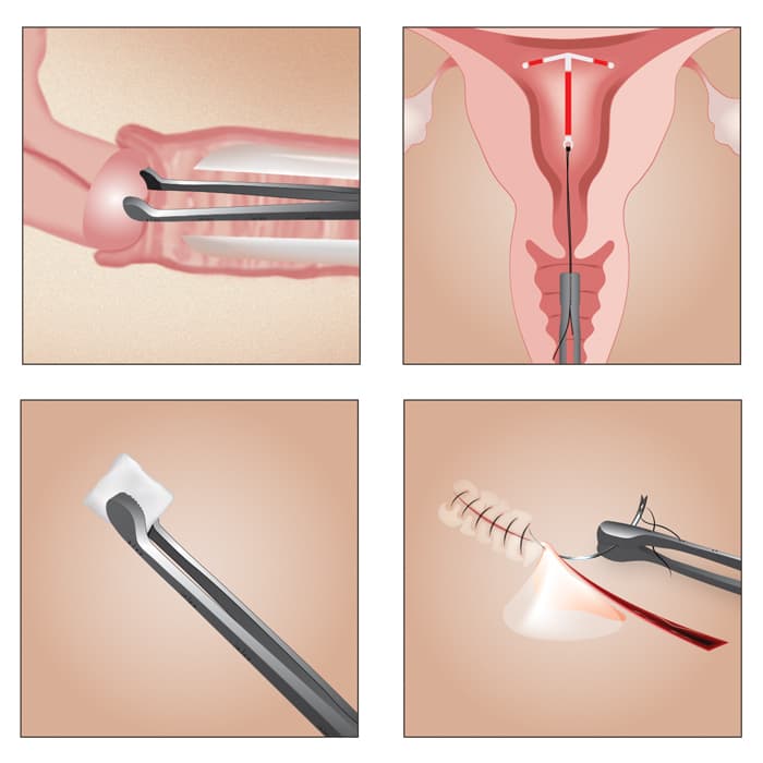Patel™ Multi-Use Forceps - thumbnail 4