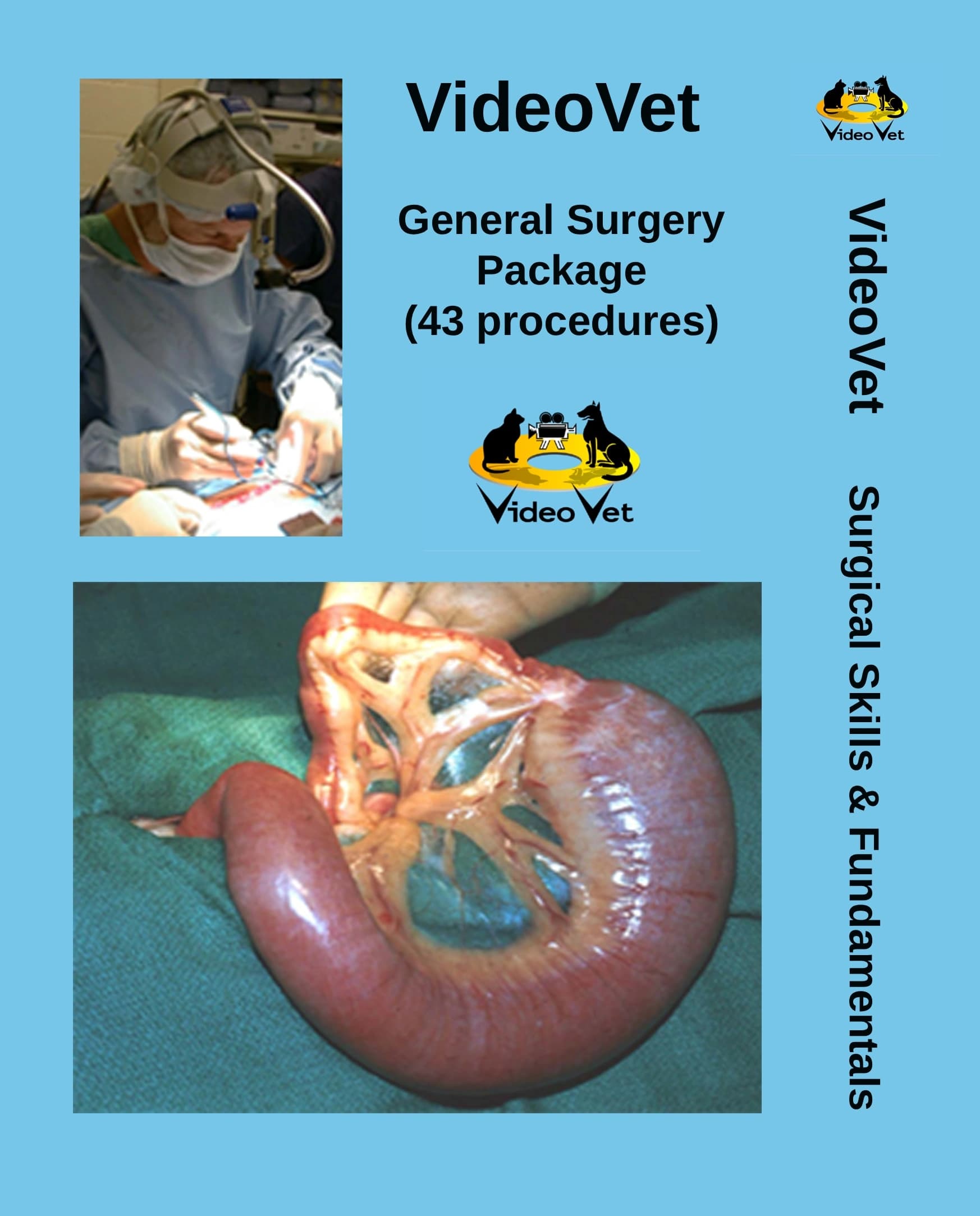 General Surgery Package (43 procedures)