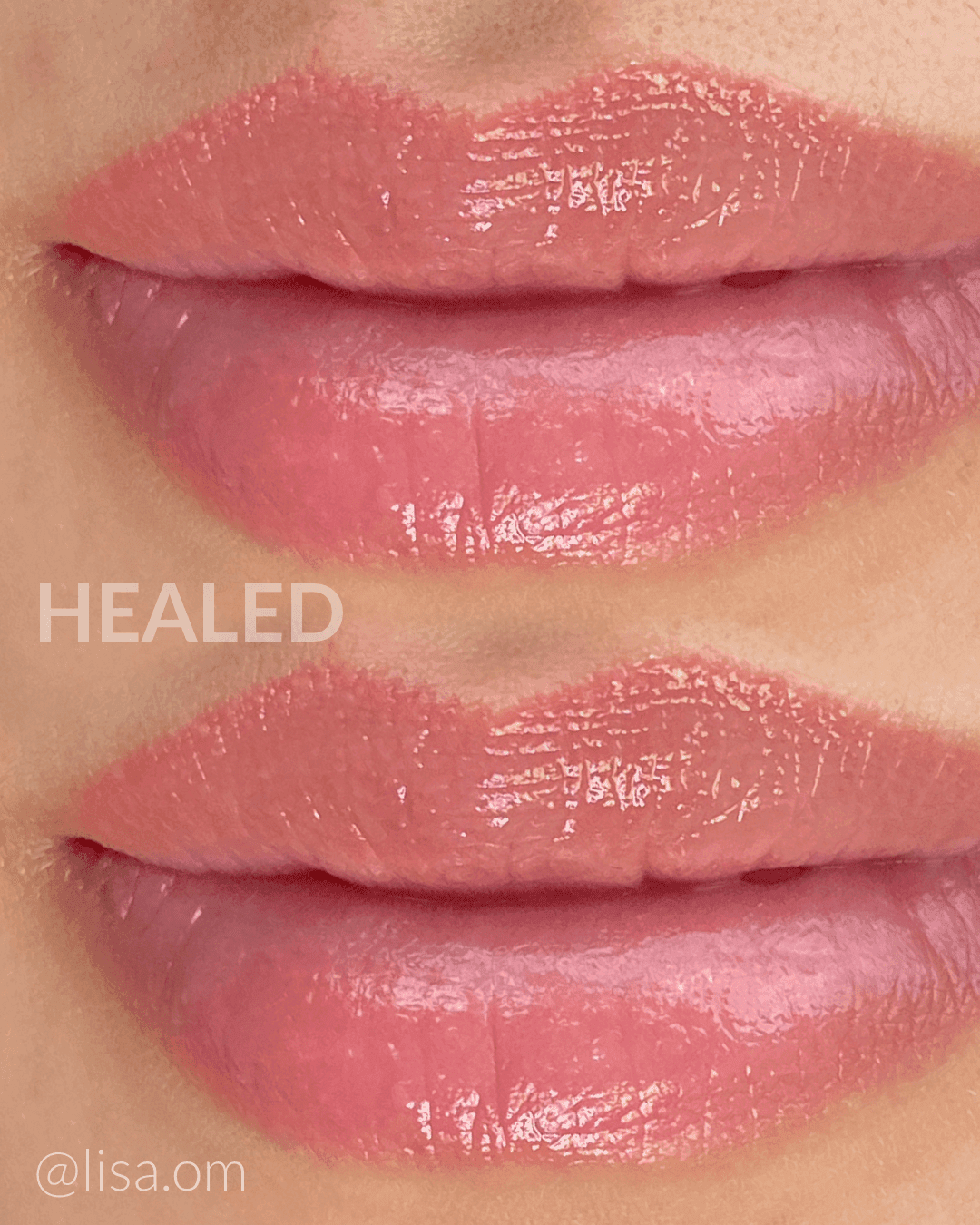 1-Day PHOENIX PMU Lip Blush & Lip Neutralization Training - thumbnail 4