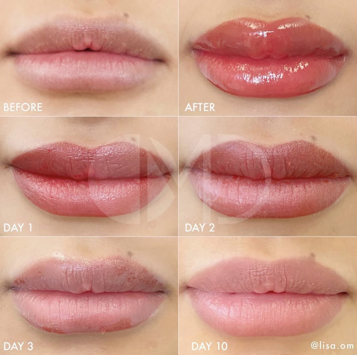 1-Day PHOENIX PMU Lip Blush & Lip Neutralization Training - thumbnail 6