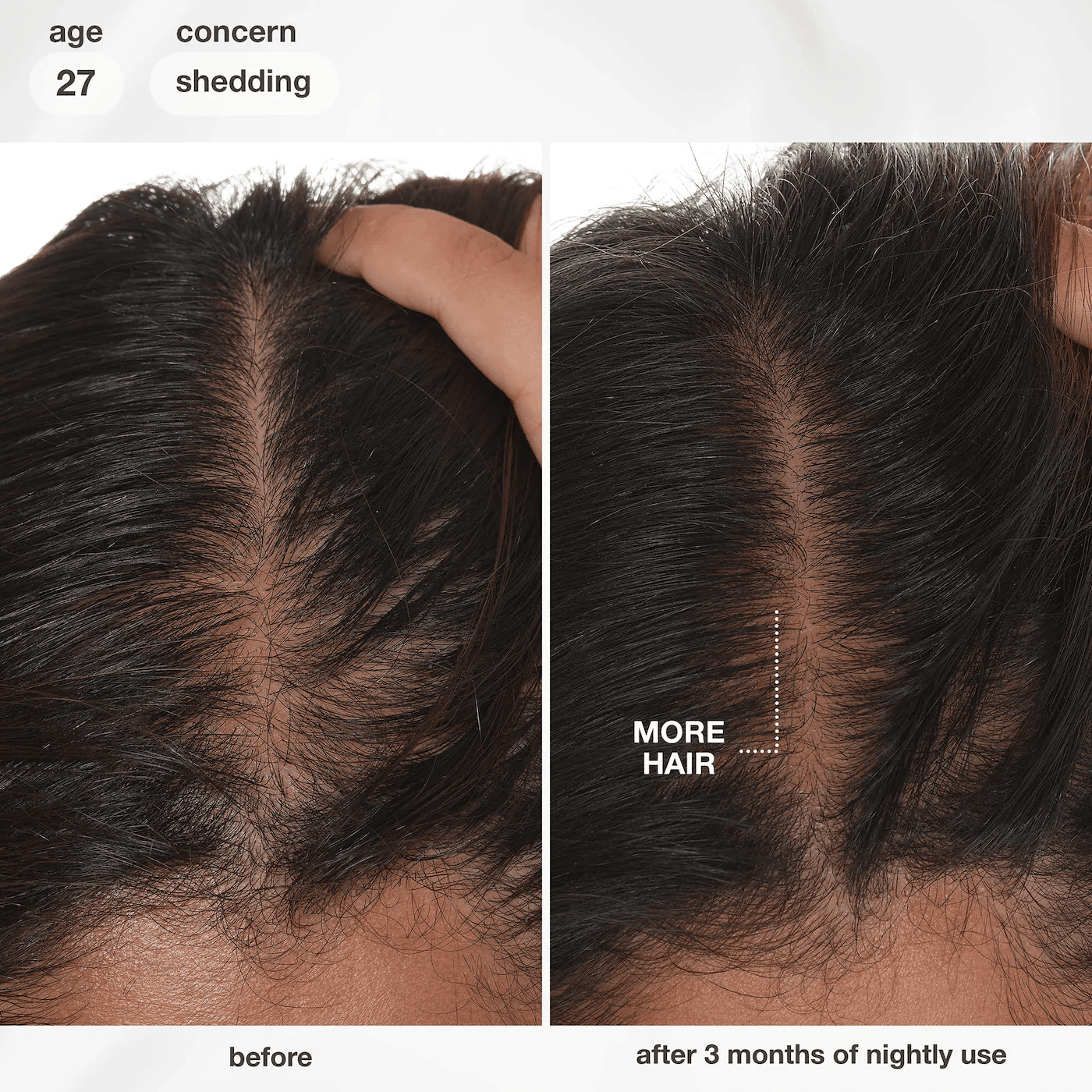 Biomimetic Hairscience  FutureIQ™ Hair Longevity Serum - thumbnail 6