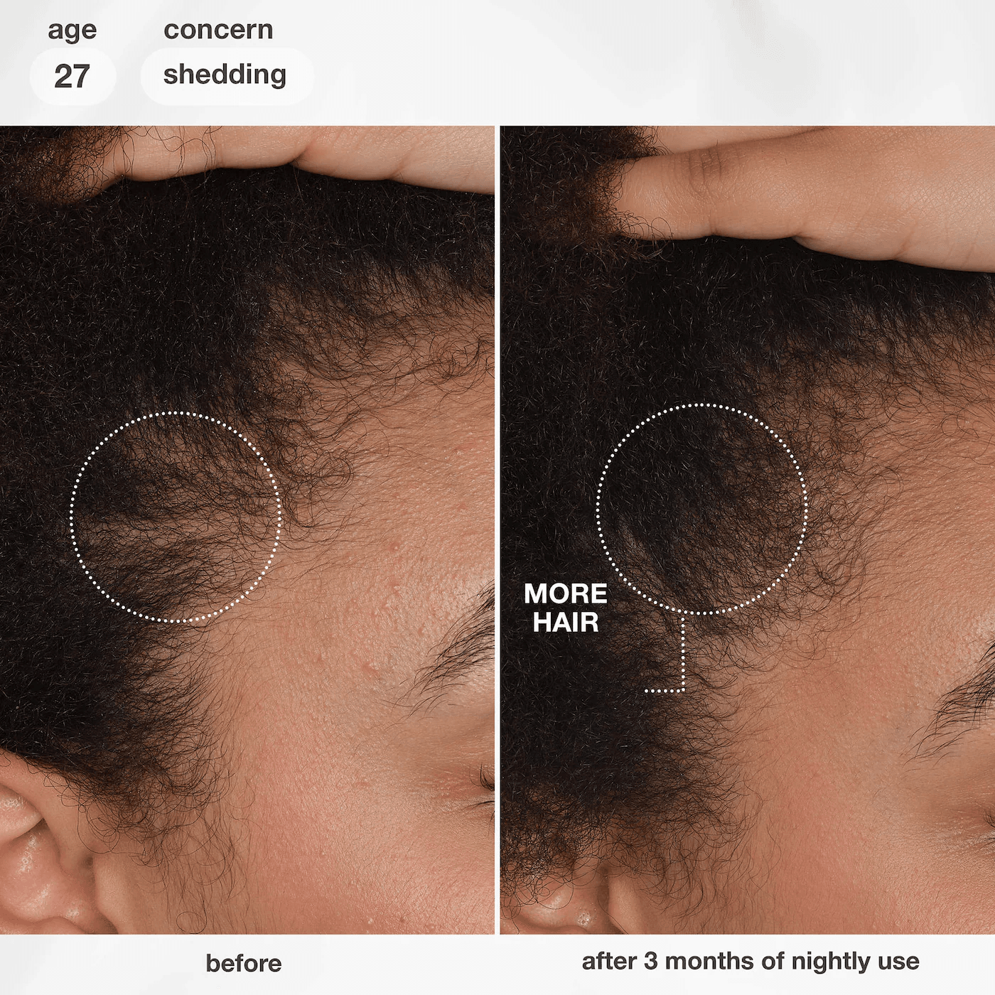 Biomimetic Hairscience  FutureIQ™ Hair Longevity Serum - thumbnail 5