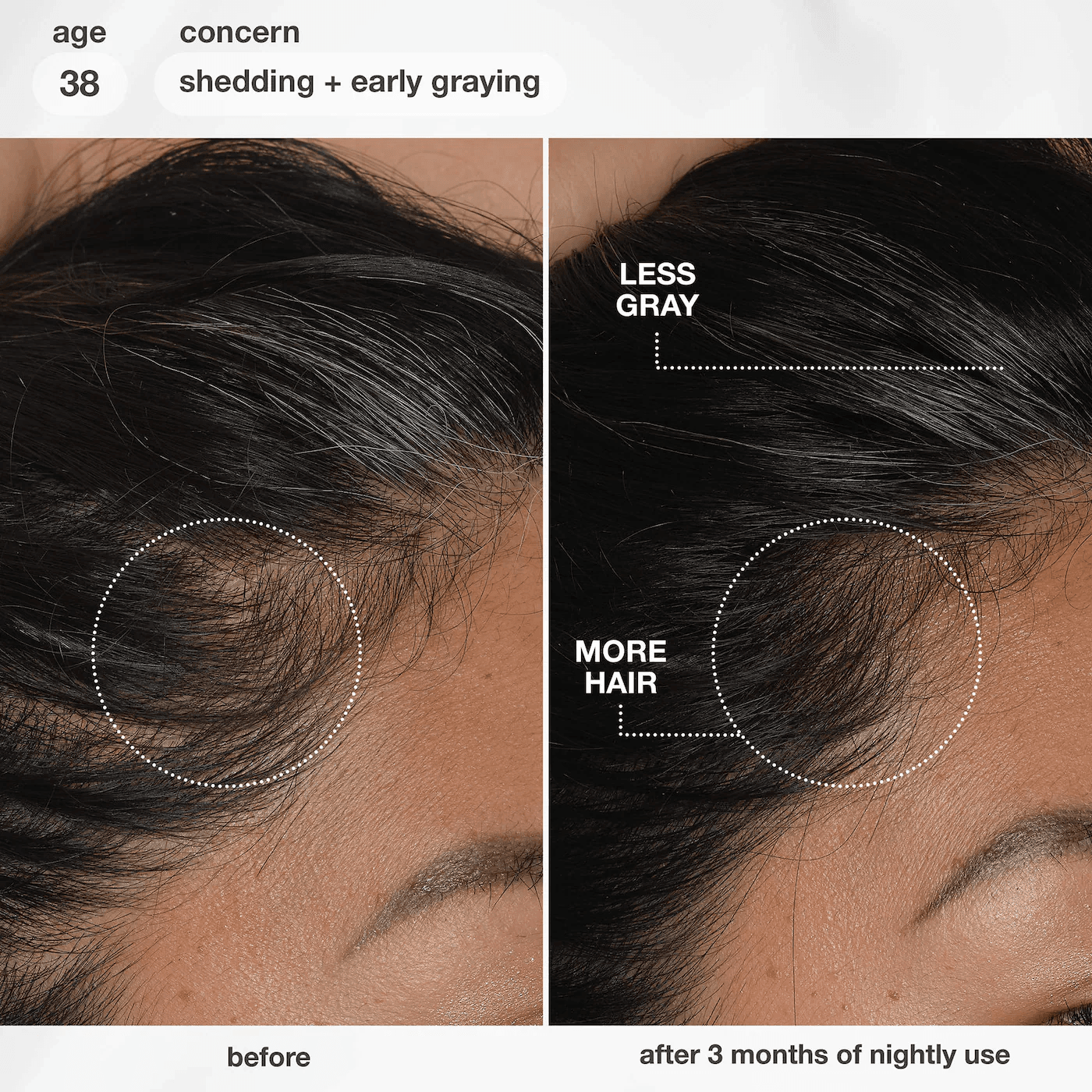Biomimetic Hairscience  FutureIQ™ Hair Longevity Serum - thumbnail 4