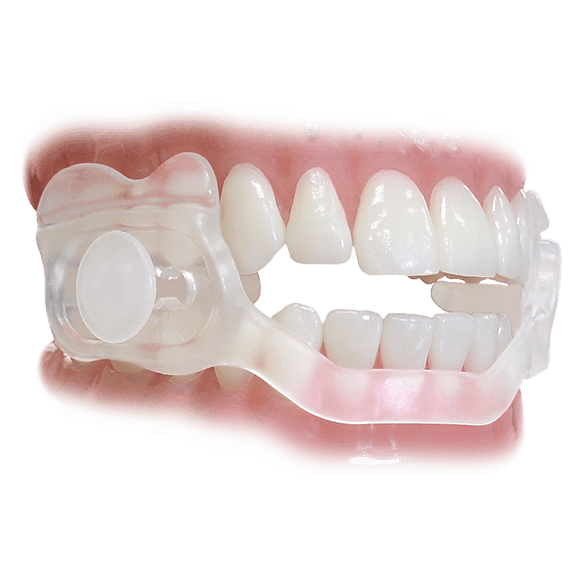 SleepRight Secure-Comfort Dental Guard - thumbnail 3