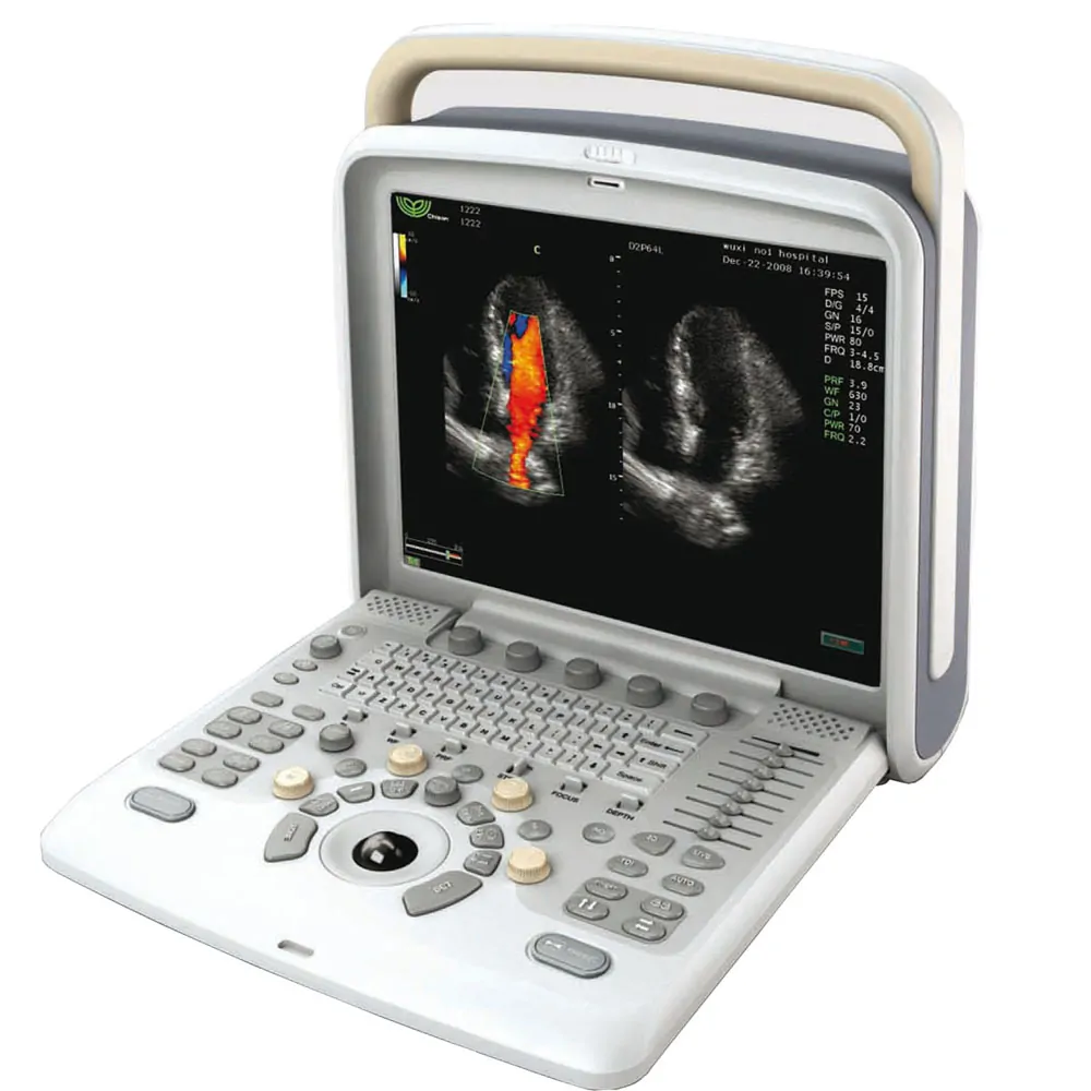 Q5 Color Ultrasound System
